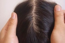 Diná Almeida propõe distribuição de perucas para pessoas com câncer